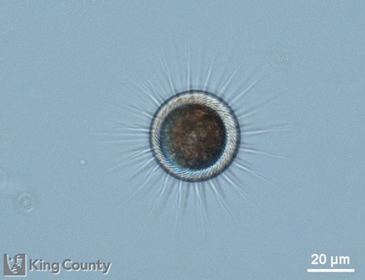 Photo of Mesodinium rubrum